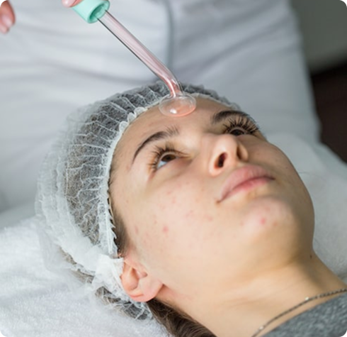 Acne Treatment